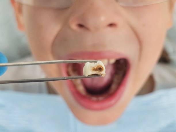 Best Emergency Dental Care for Sports Injuries in Blanchester, OH